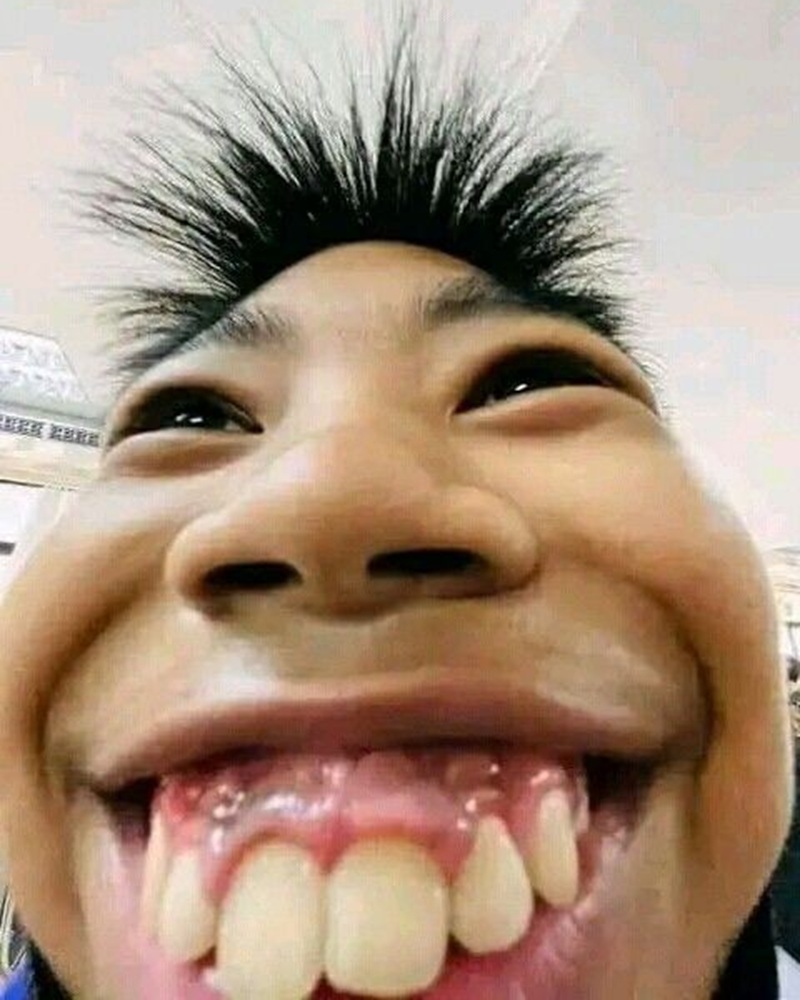 big smile goofy ahh pictures teeth